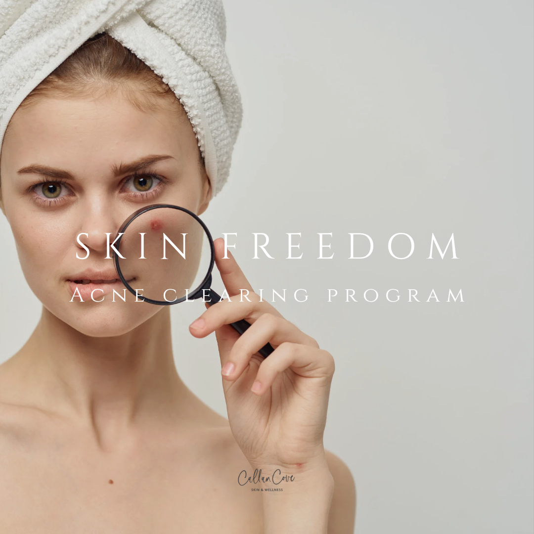 Acne Clearing Program